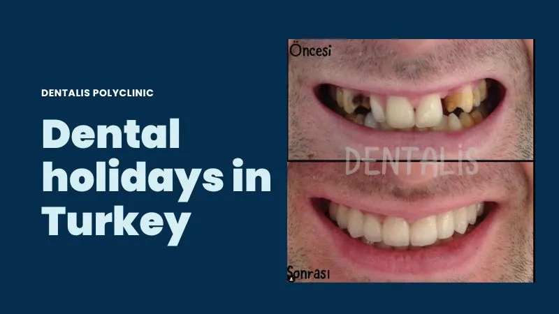 Dental holidays in Istanbul