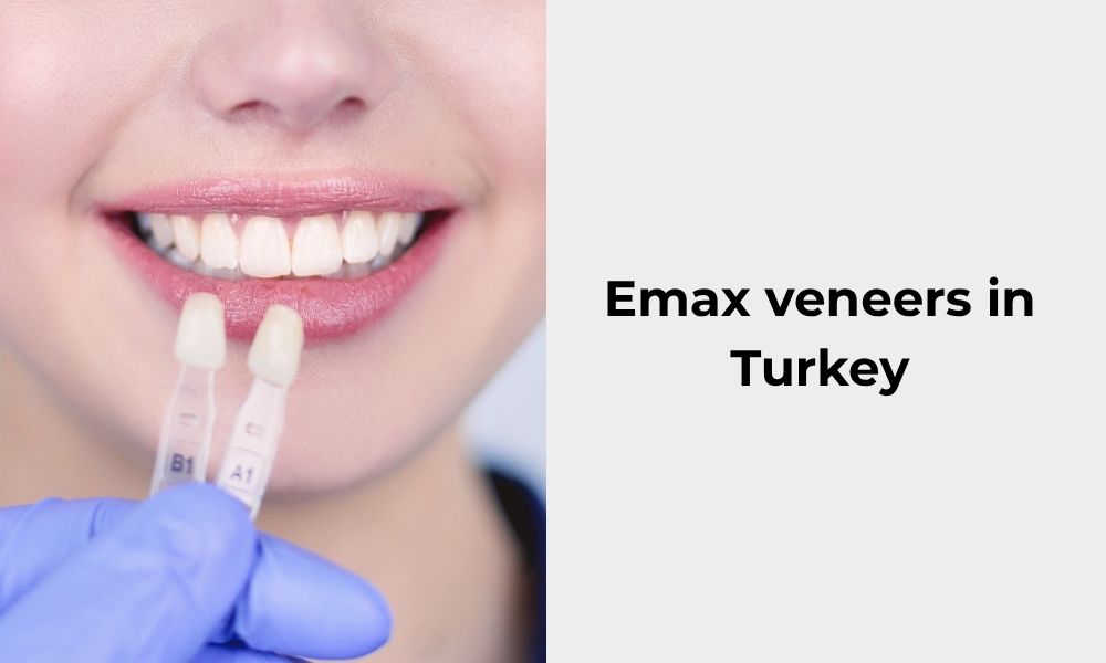 Emax laminate veneers Istanbul